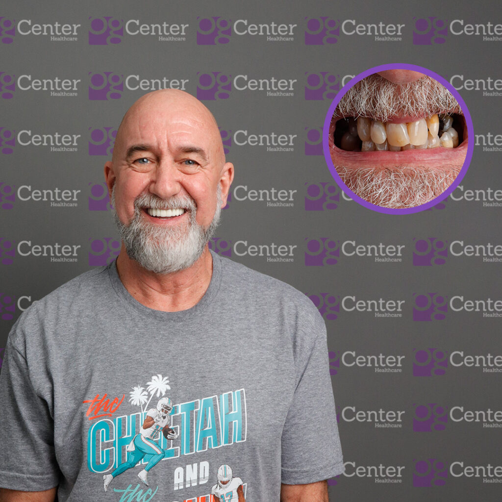 Paciente sonriendo en la clínica OG Center; incluye una fotografía de sus dientes antes del tratamiento.