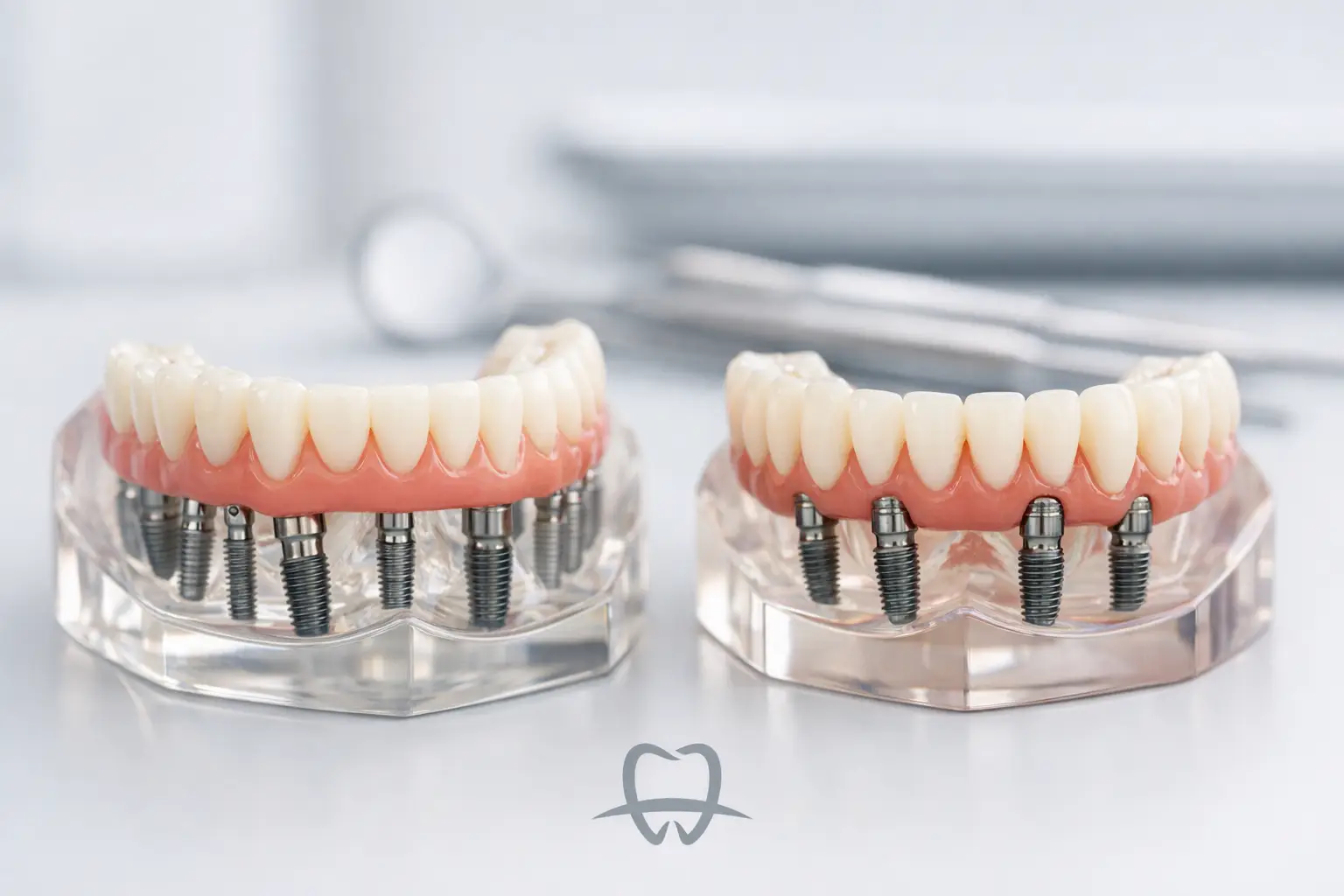 All-on-X vs All-on-4: implantes dentales All-on-X vs All-on-4: implantes dentales