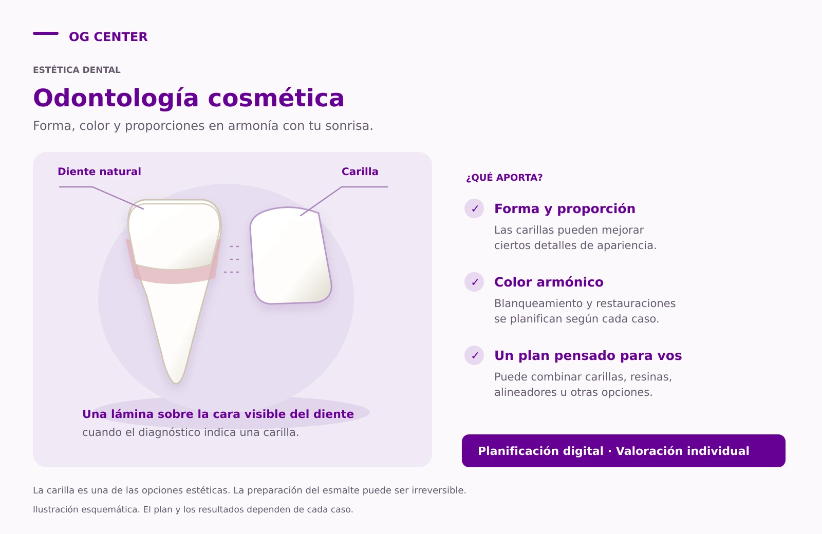 Ilustración de un diente natural y una carilla, una de las opciones de odontología cosmética para modificar forma y apariencia.